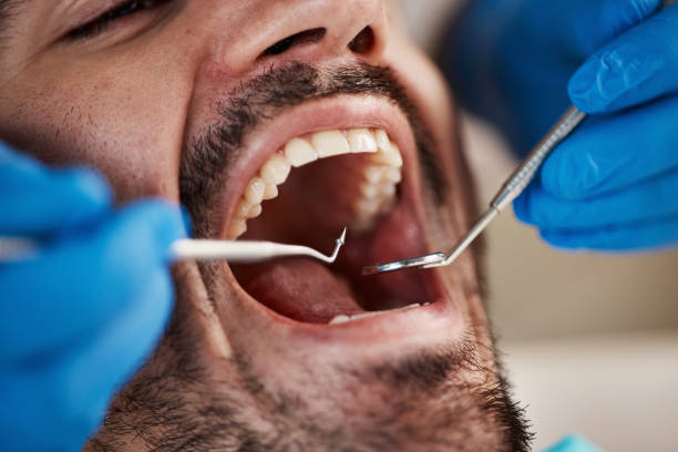Best Cosmetic Emergency Dentistry in Houghton Lake, MI